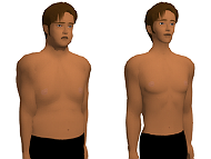 Image depicting before and after weight loss (image by Asanagi - Own work, CC0)