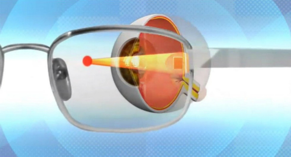 An infrared beam from special (rechargeable) high glasses keeps the implant charged.