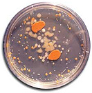 Bacteria community(Illustration photo)