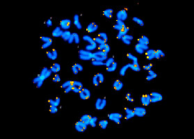 human telomeres highlighed by a fluorescent probe to the human telomere base sequence