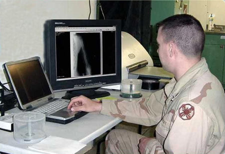 U.S. army technician reviewing a patient x-ray on the Orex CR unit
